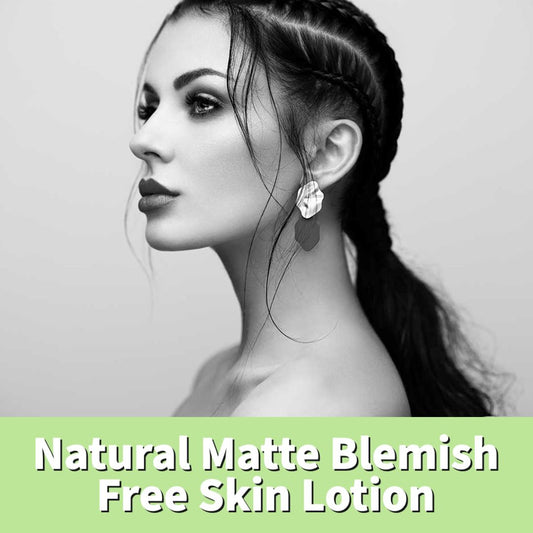 Natural Matte Blemish Free Skin Cream - For Oily Sensitive Acne Skin